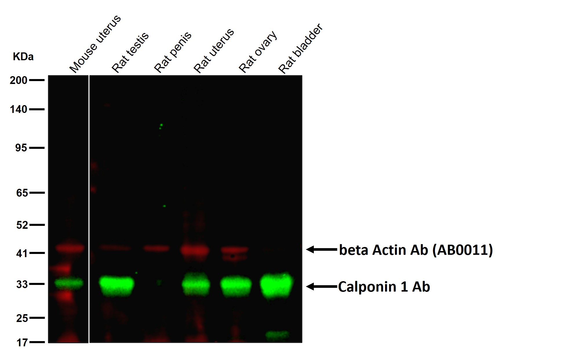 Calponin 1 Ab