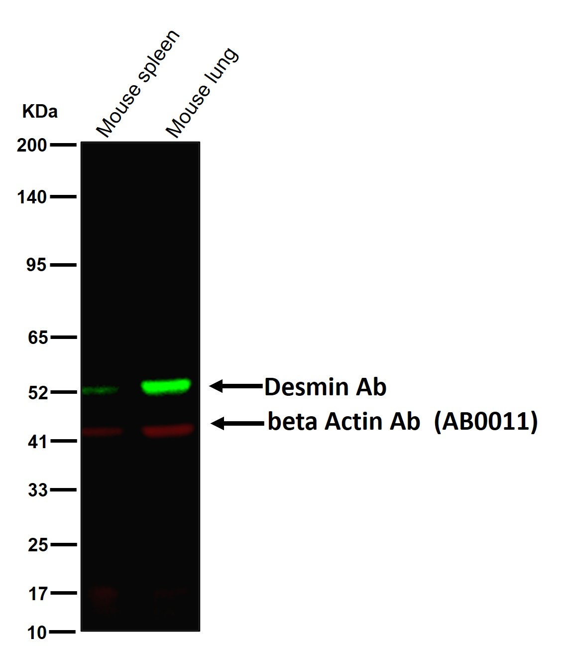 Desmin Ab