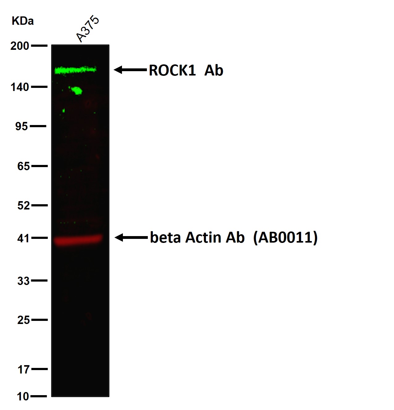 ROCK1 Ab
