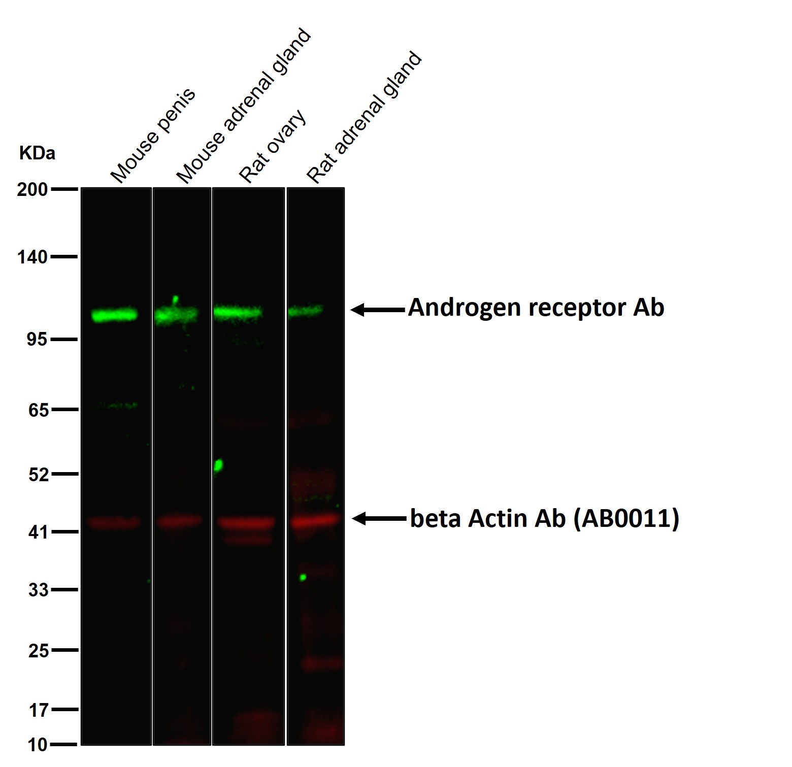Androgen receptor Ab