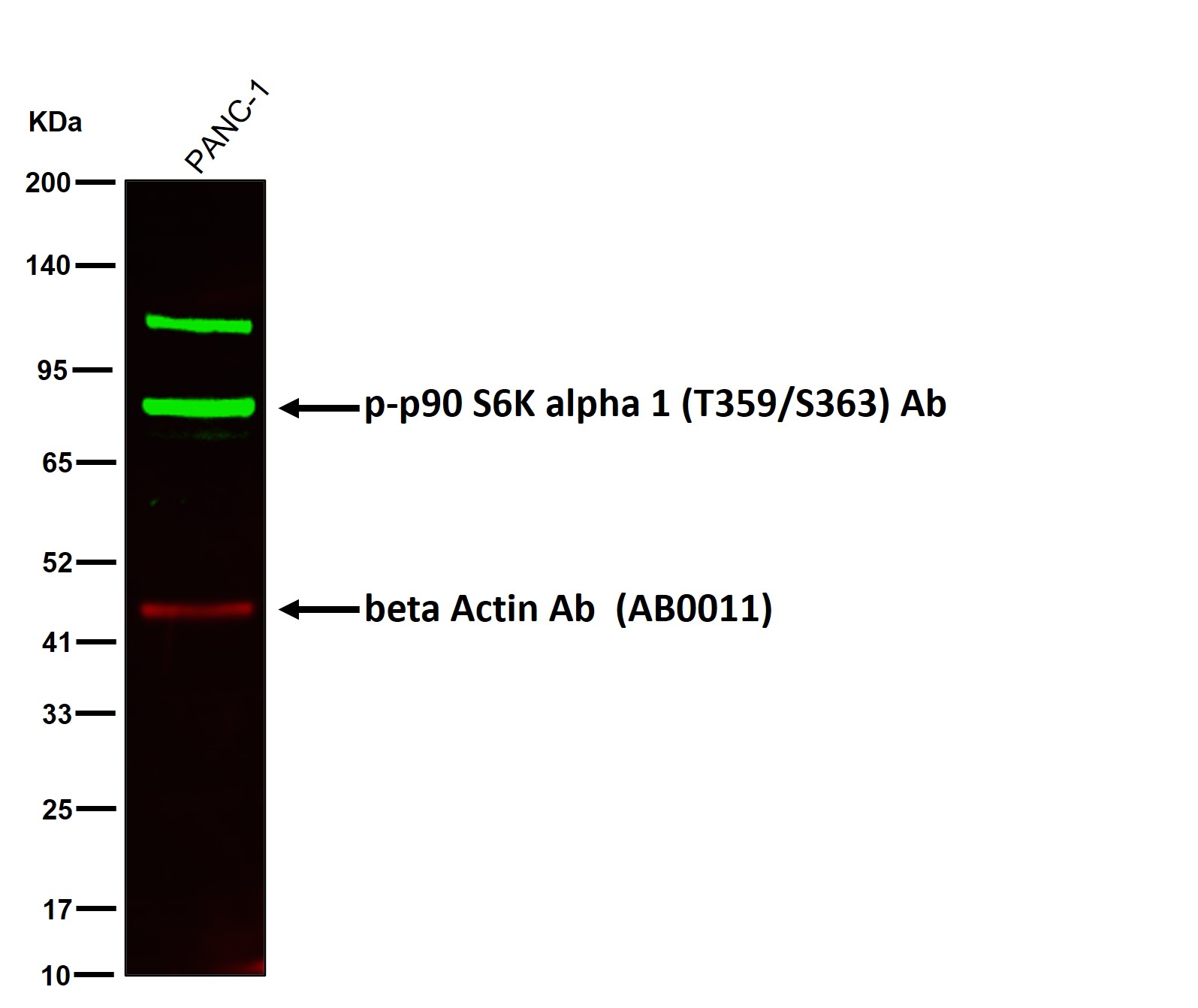 p-p90 S6K alpha 1 (T359/S363) Ab