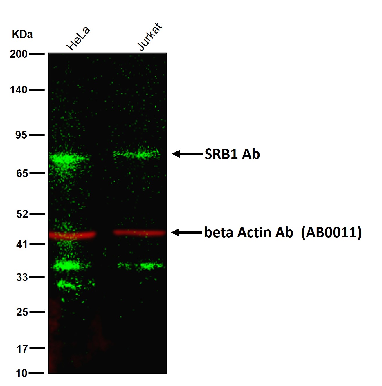 SRB1 Ab