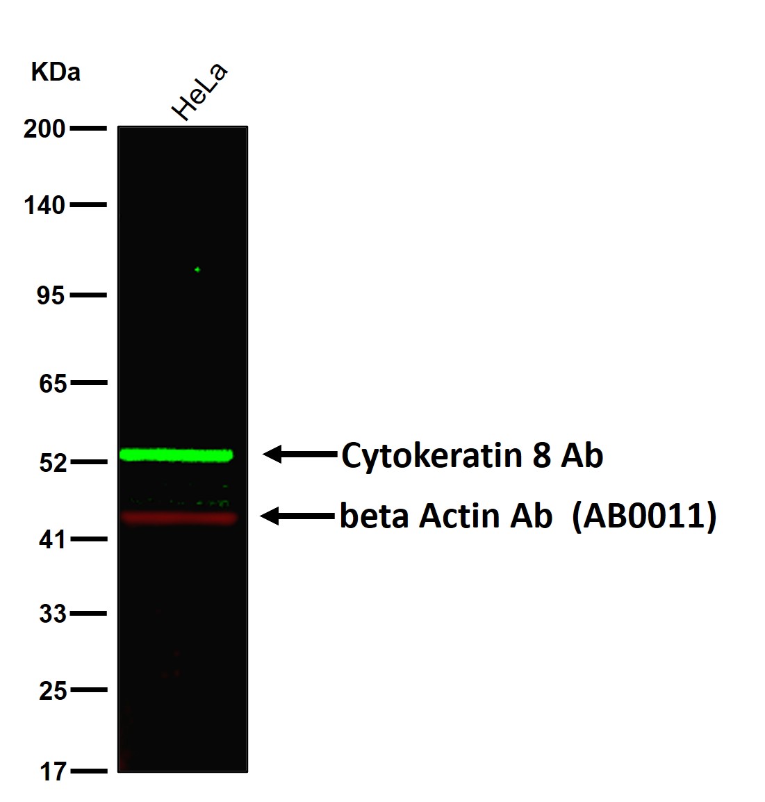 Cytokeratin 8 Ab