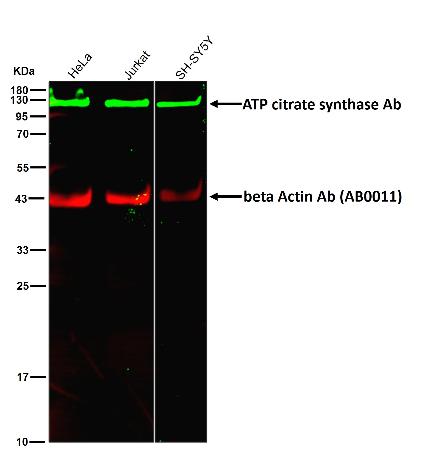 ATP citrate synthase Ab