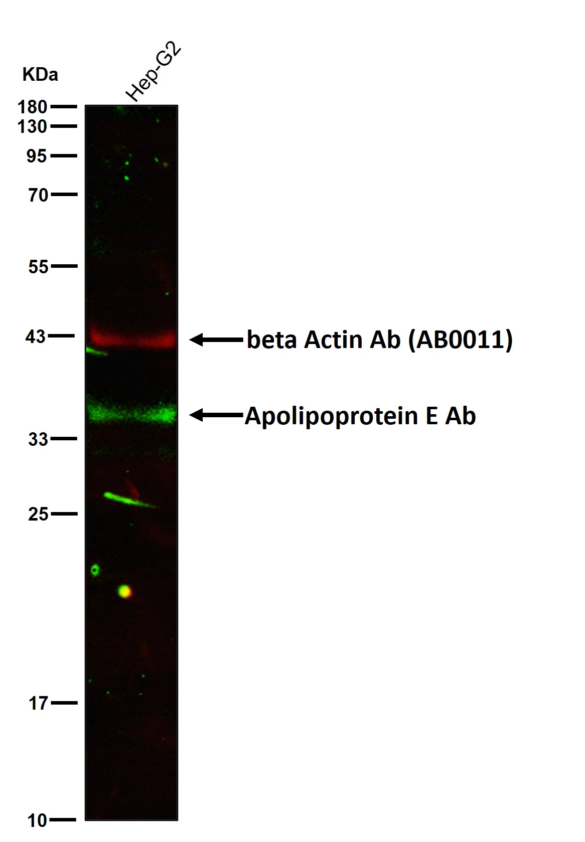 Apolipoprotein E Ab