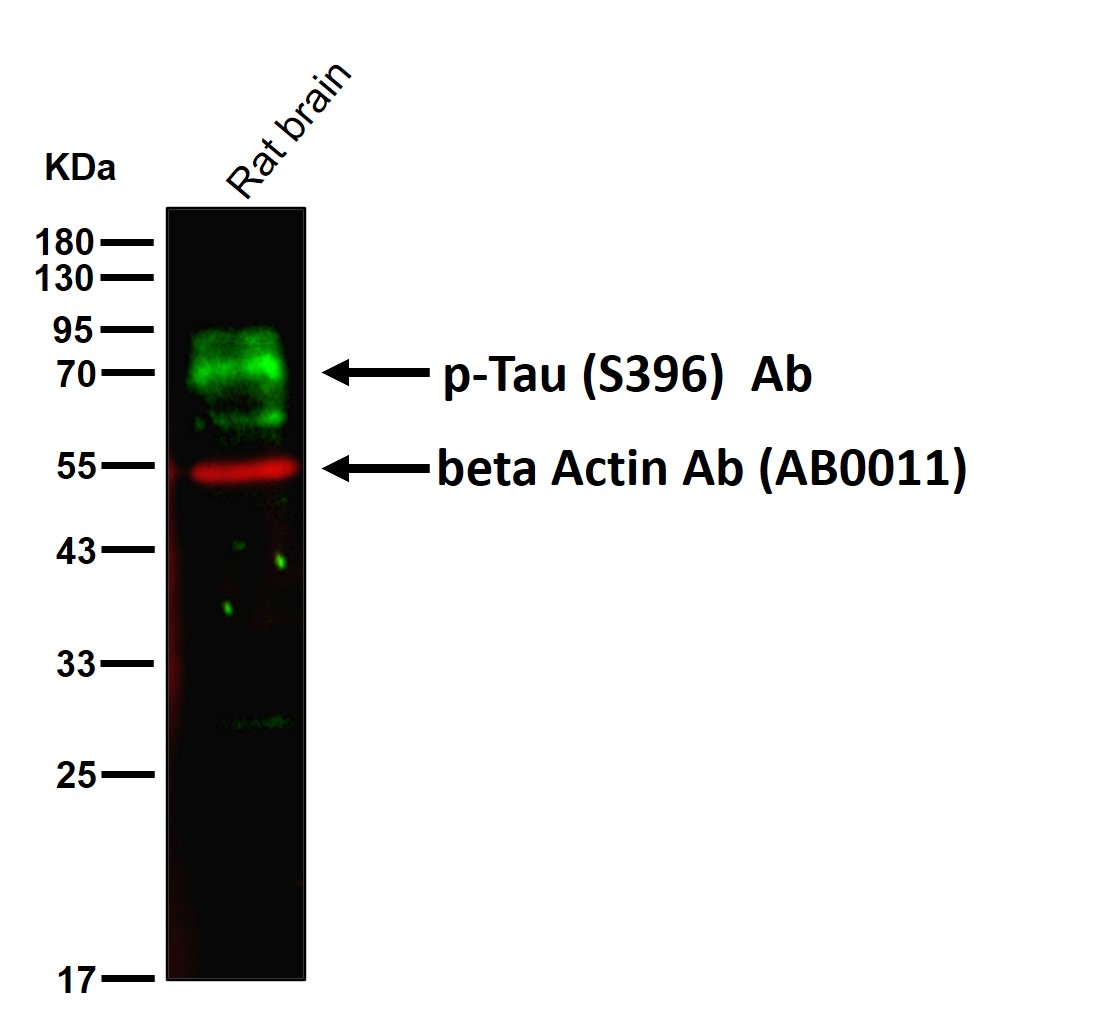 p-Tau (S396) Ab