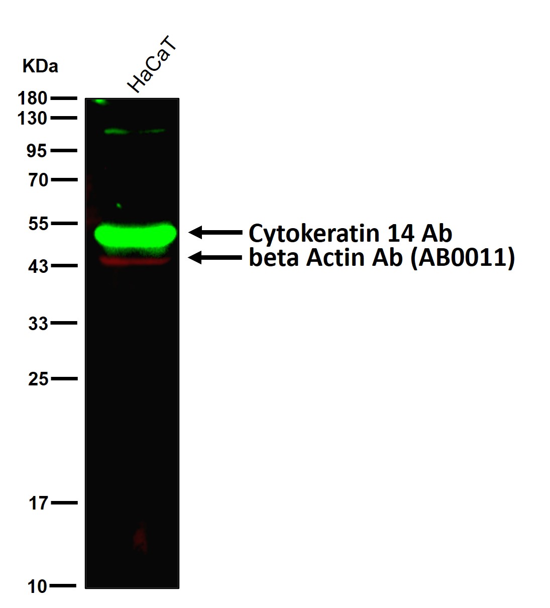 Cytokeratin 14 Ab