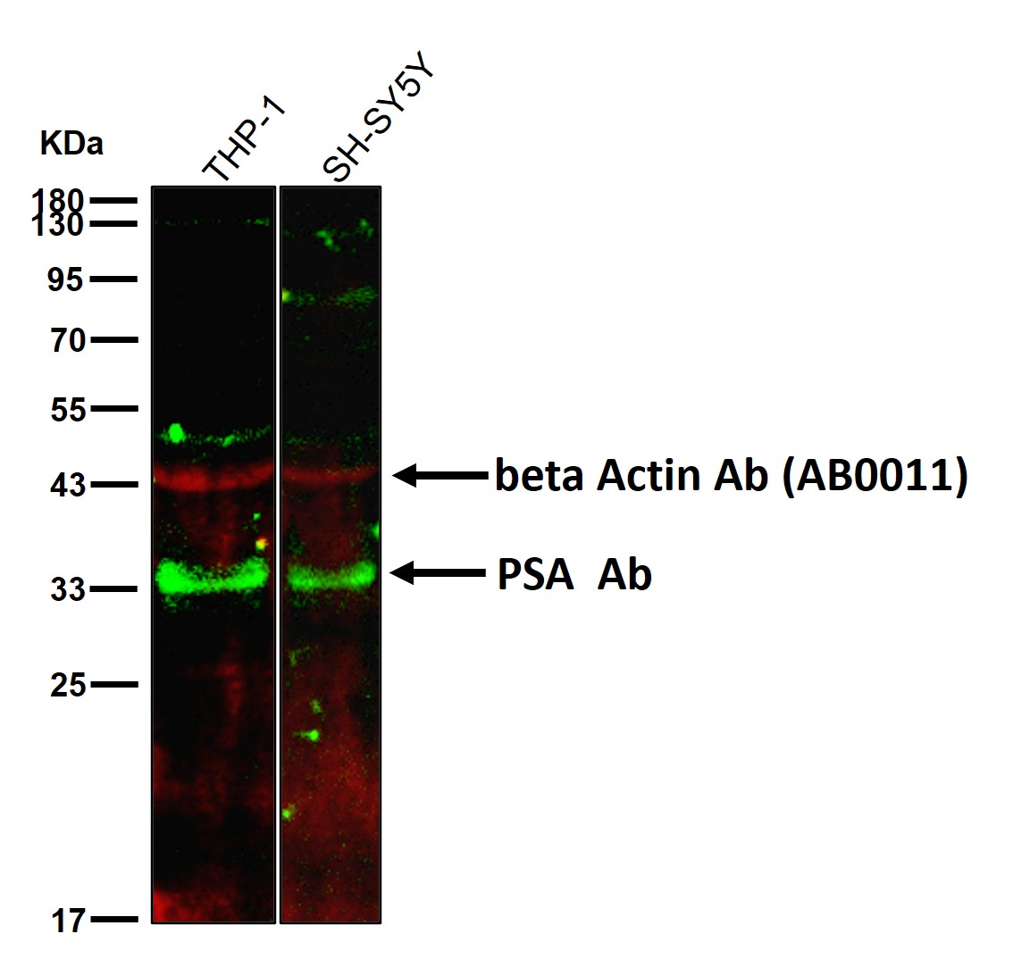 PSA Ab