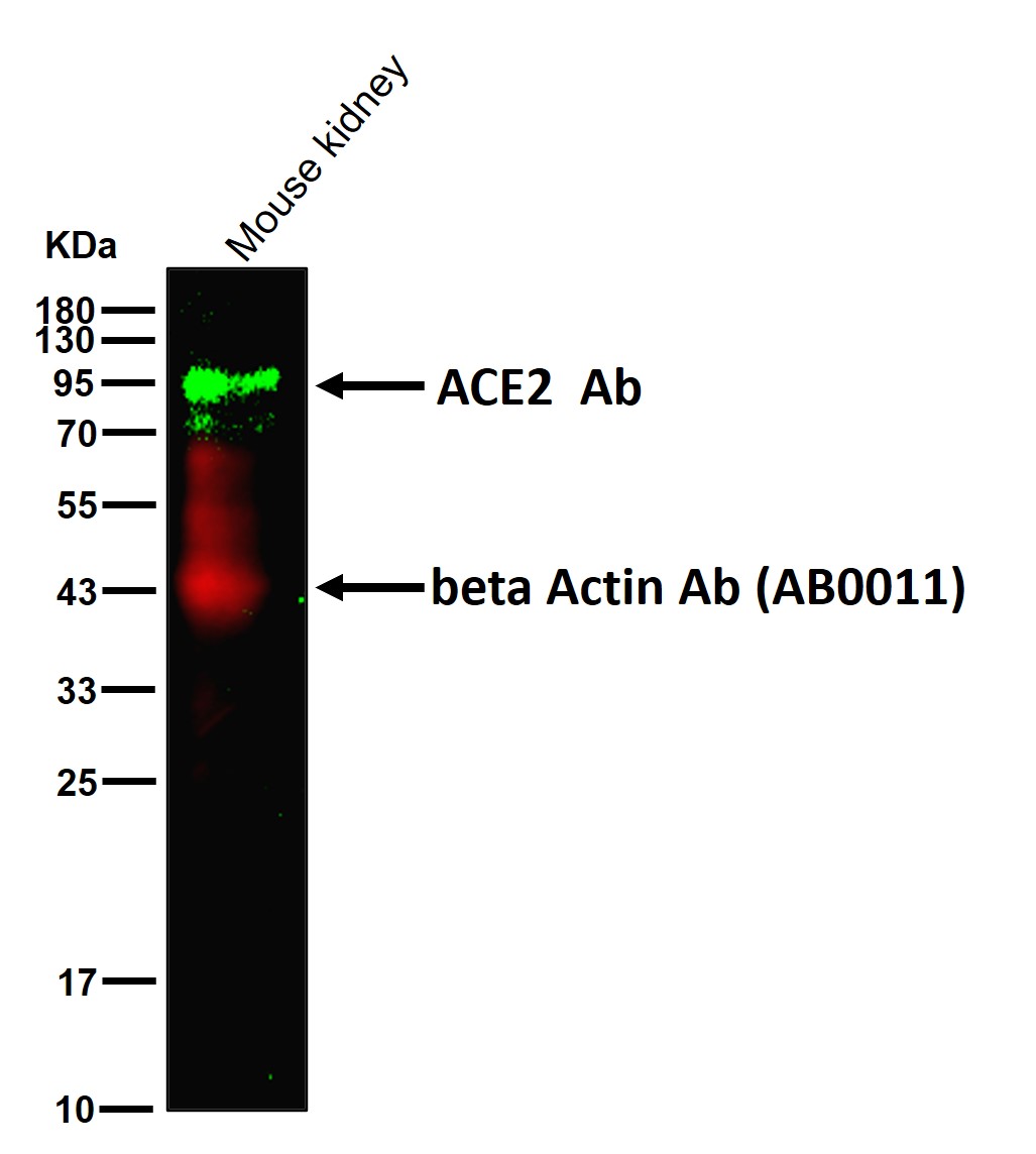 ACE2 Ab