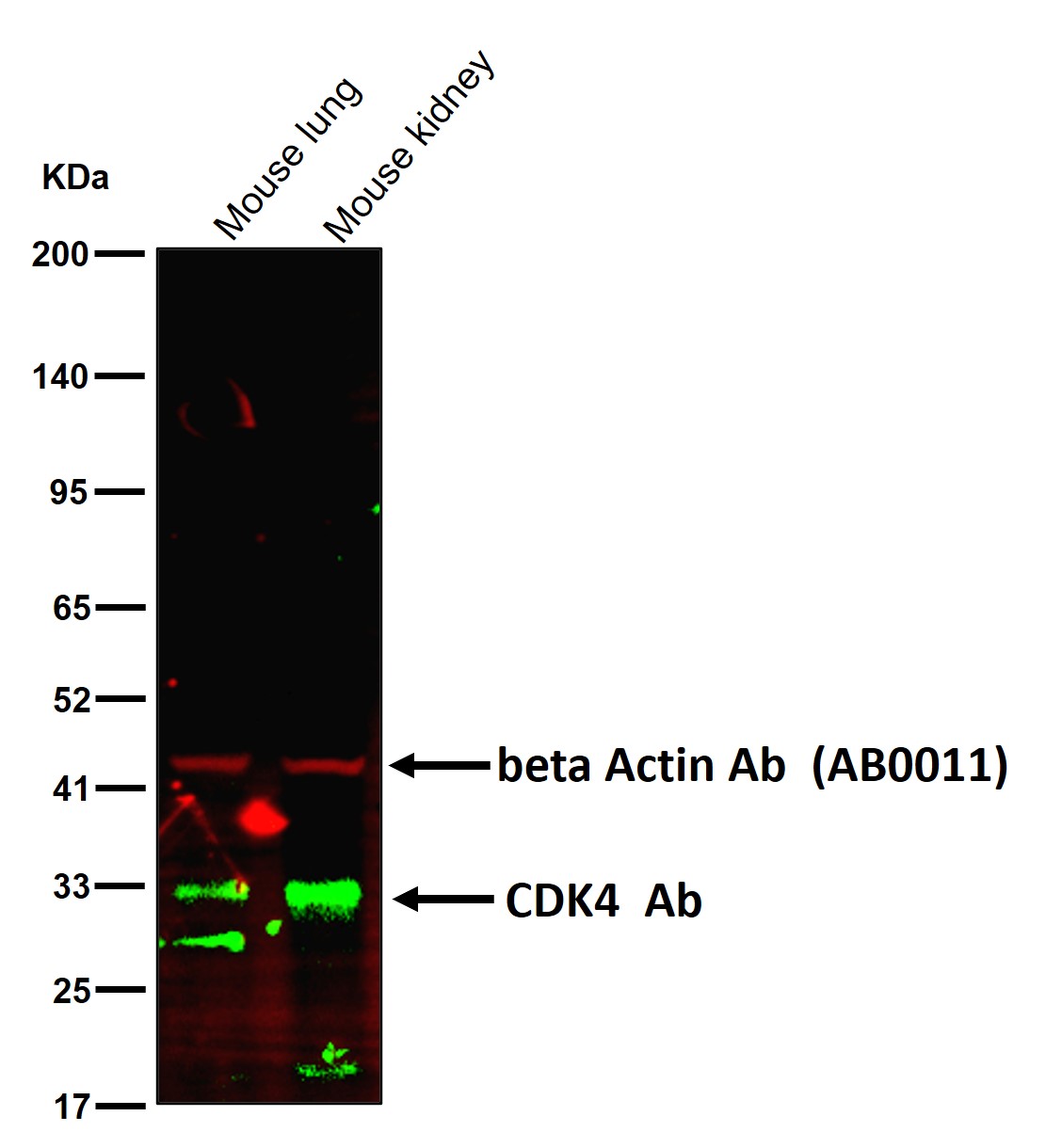 CDK4 Ab