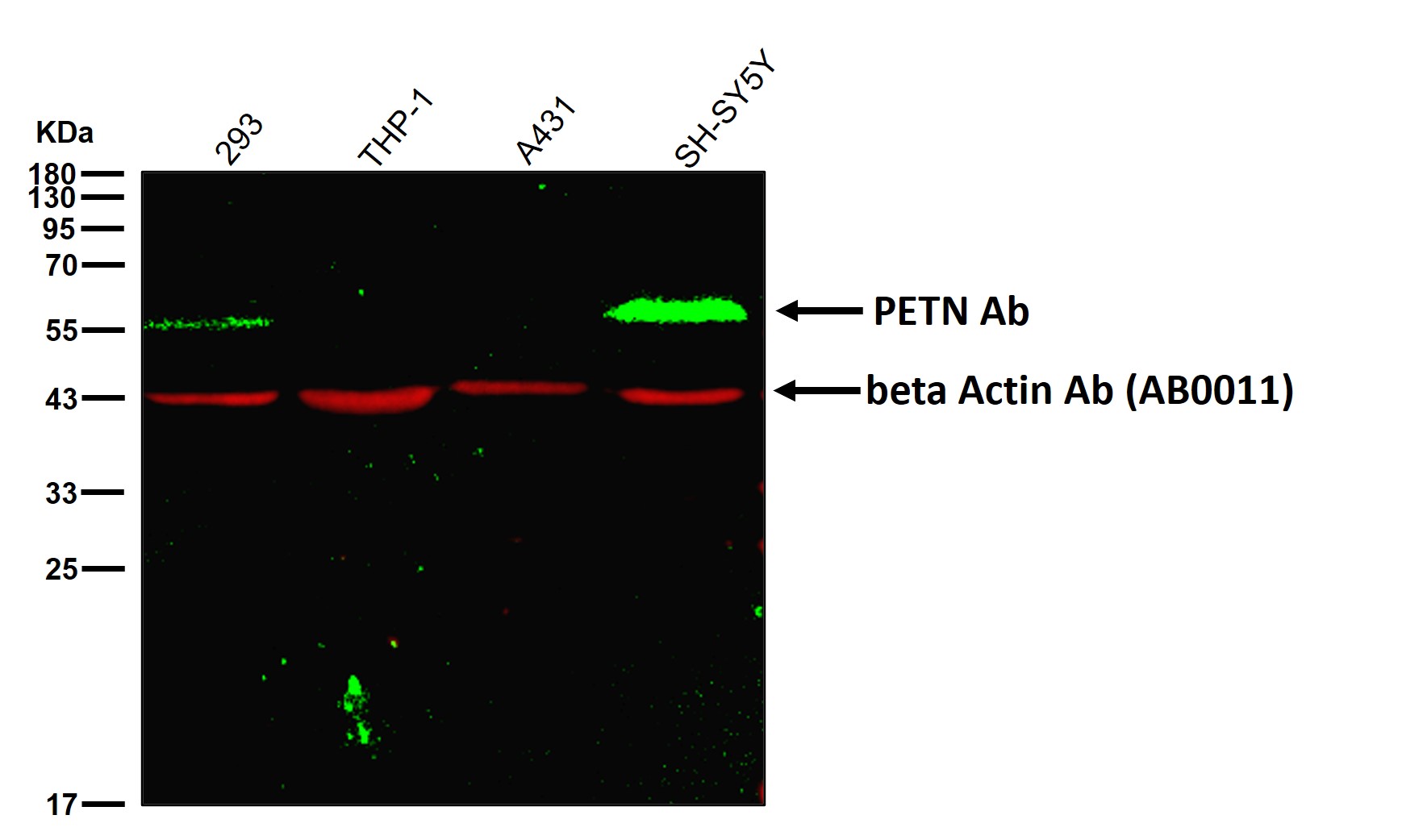 PTEN Ab