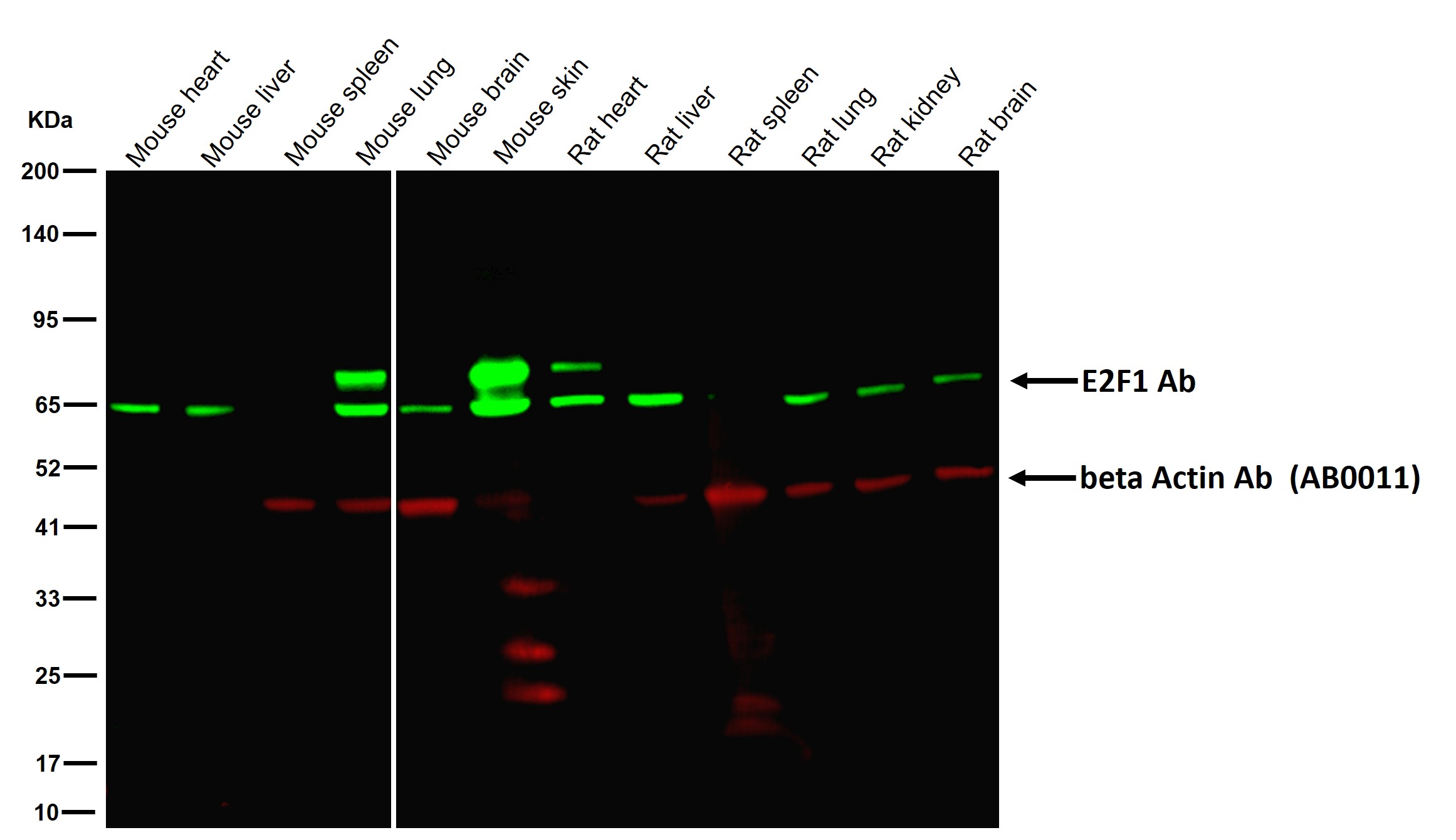 E2F1 Ab
