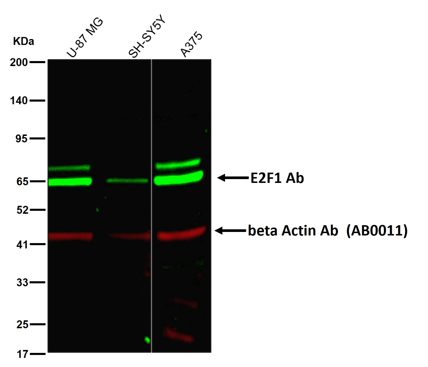 E2F1 Ab