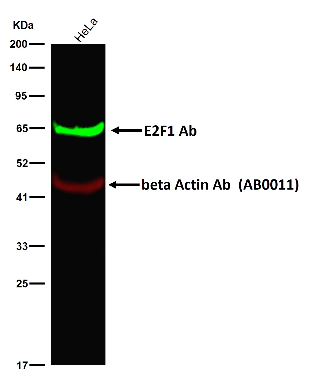 E2F1 Ab