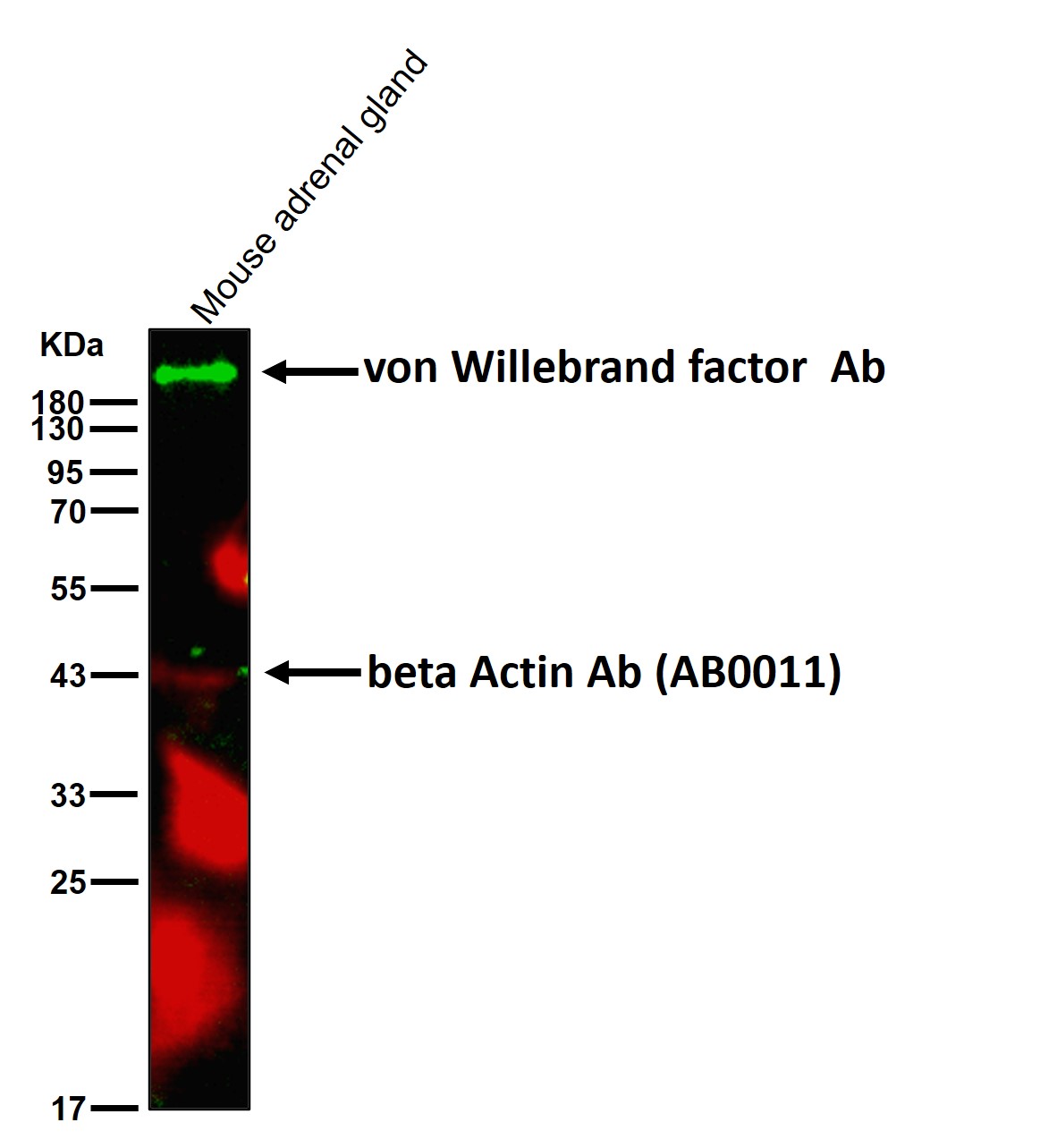 von Willebrand factor Ab