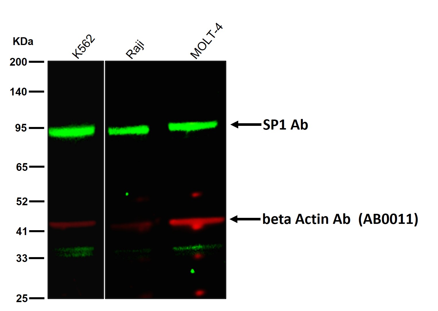 SP1 Ab
