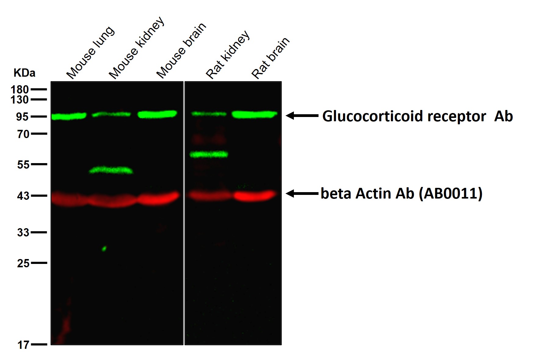 Glucocorticoid receptor Ab