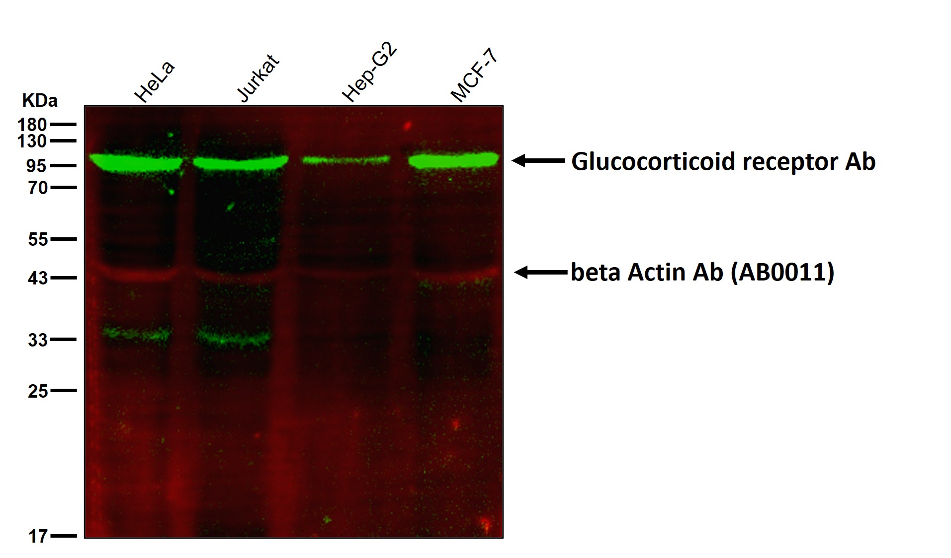 Glucocorticoid receptor Ab