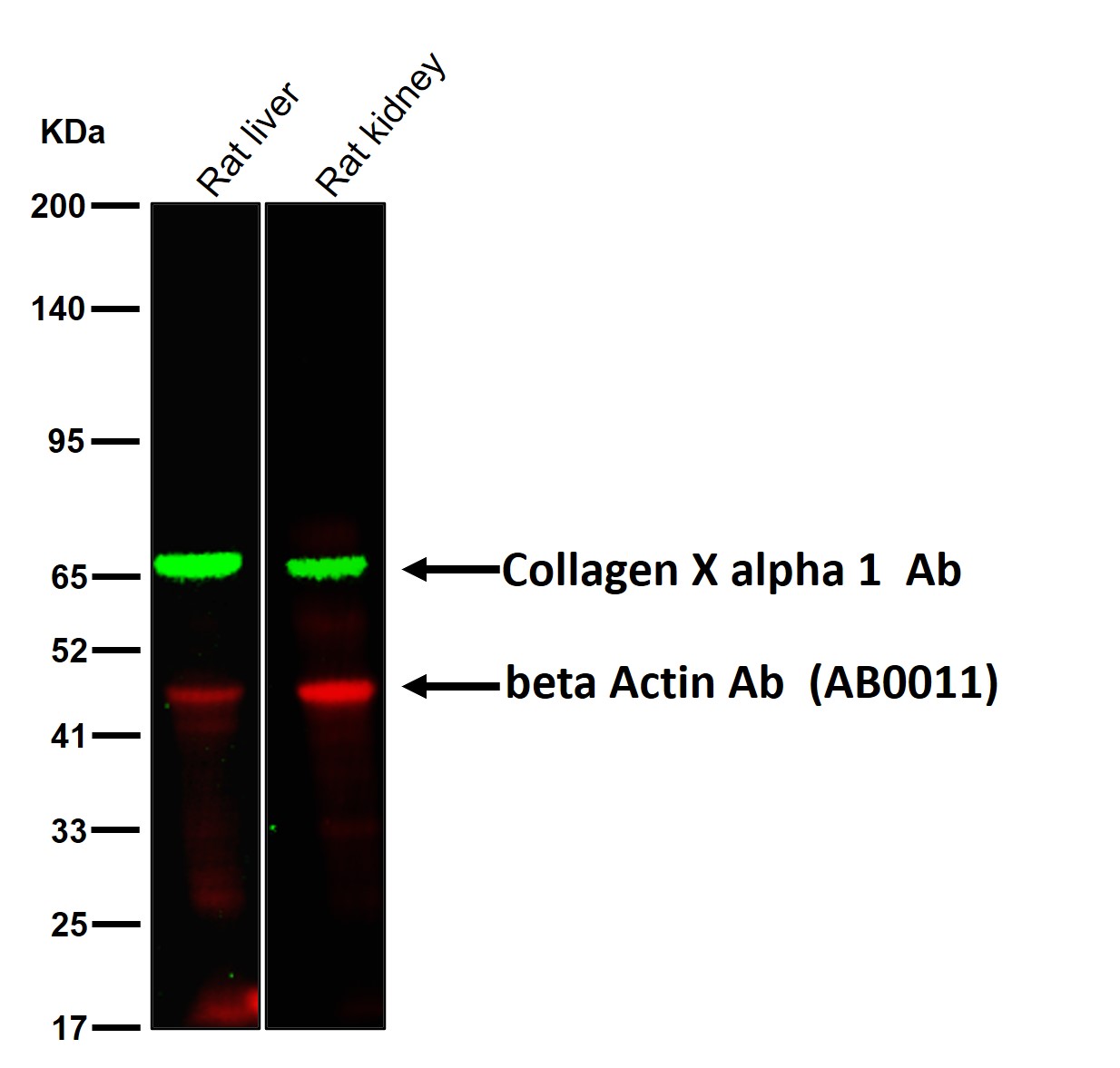 Collagen X alpha 1 Ab