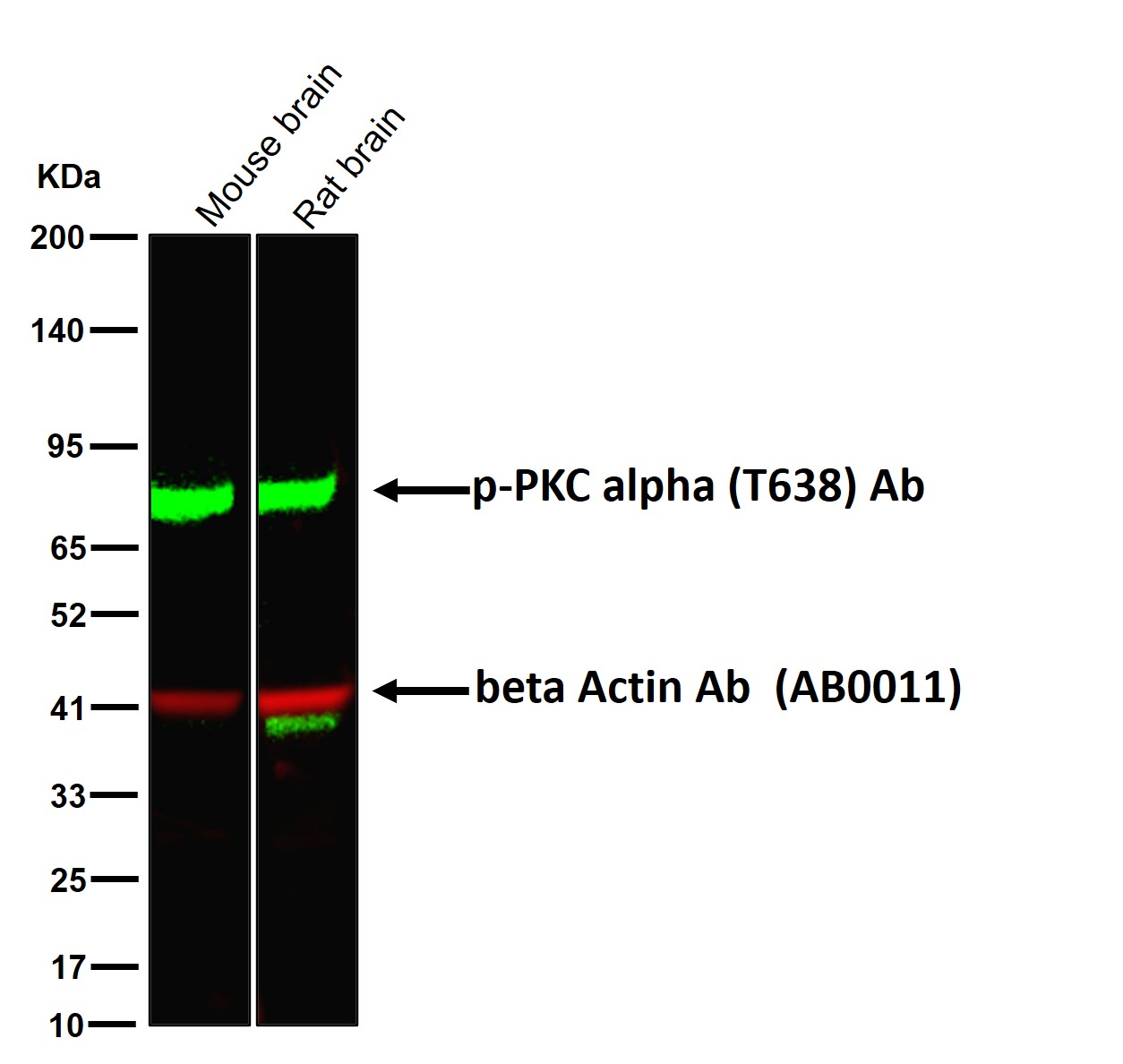 p-PKC alpha (T638) Ab
