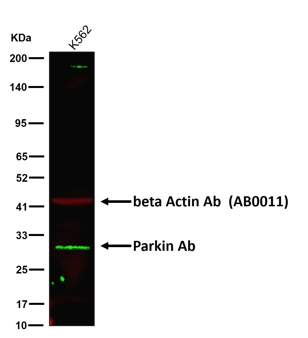 Parkin Ab