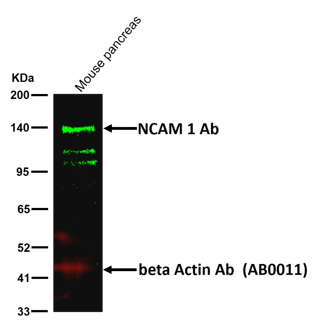 NCAM 1 Ab