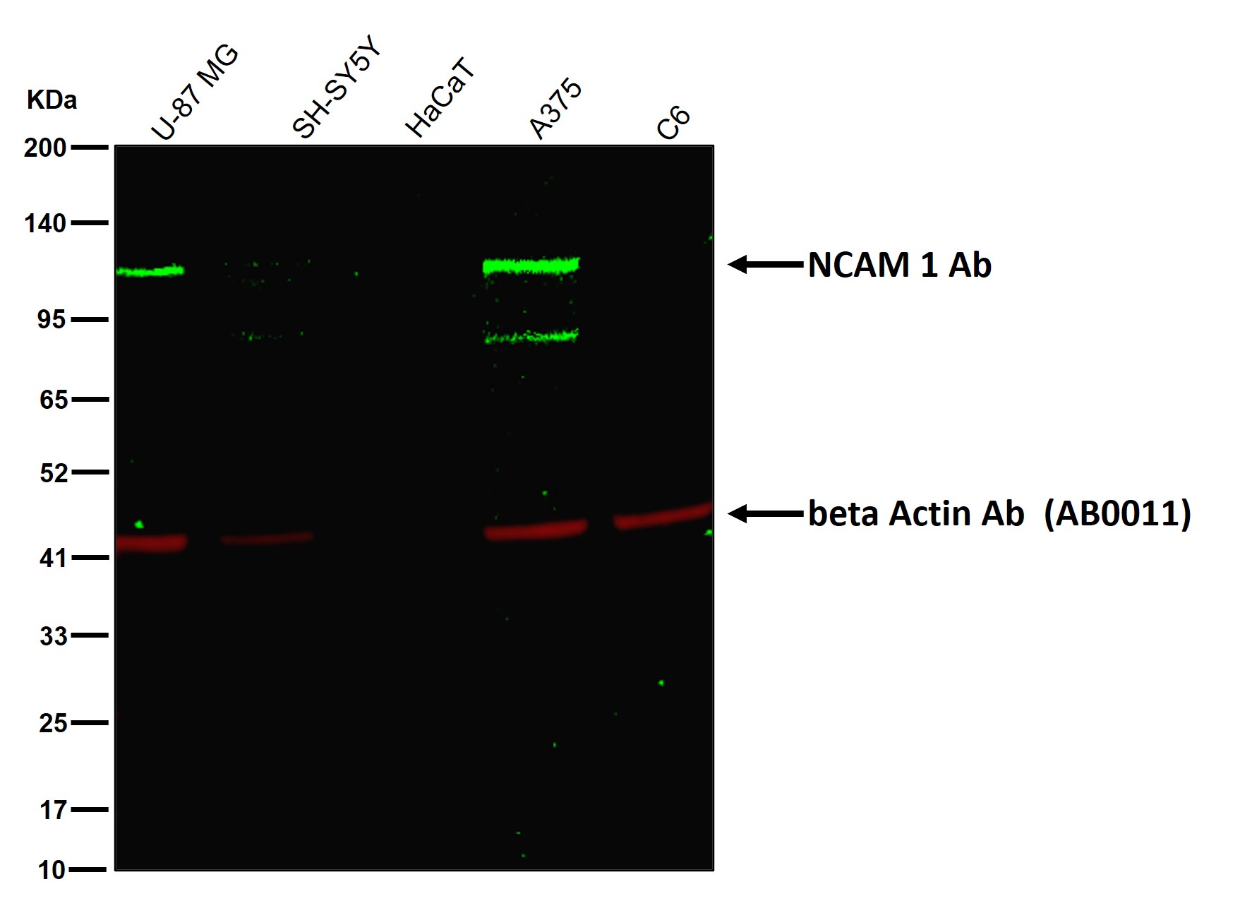 NCAM 1 Ab