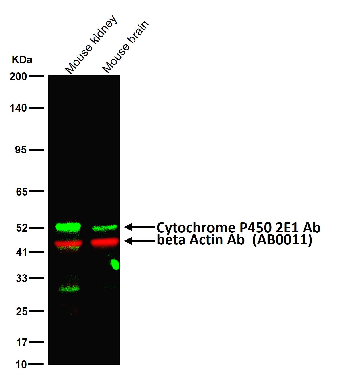 Cytochrome P450 2E1 Ab