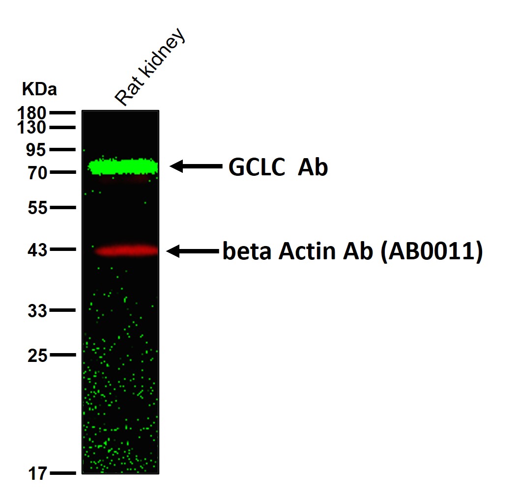 GCLC Ab