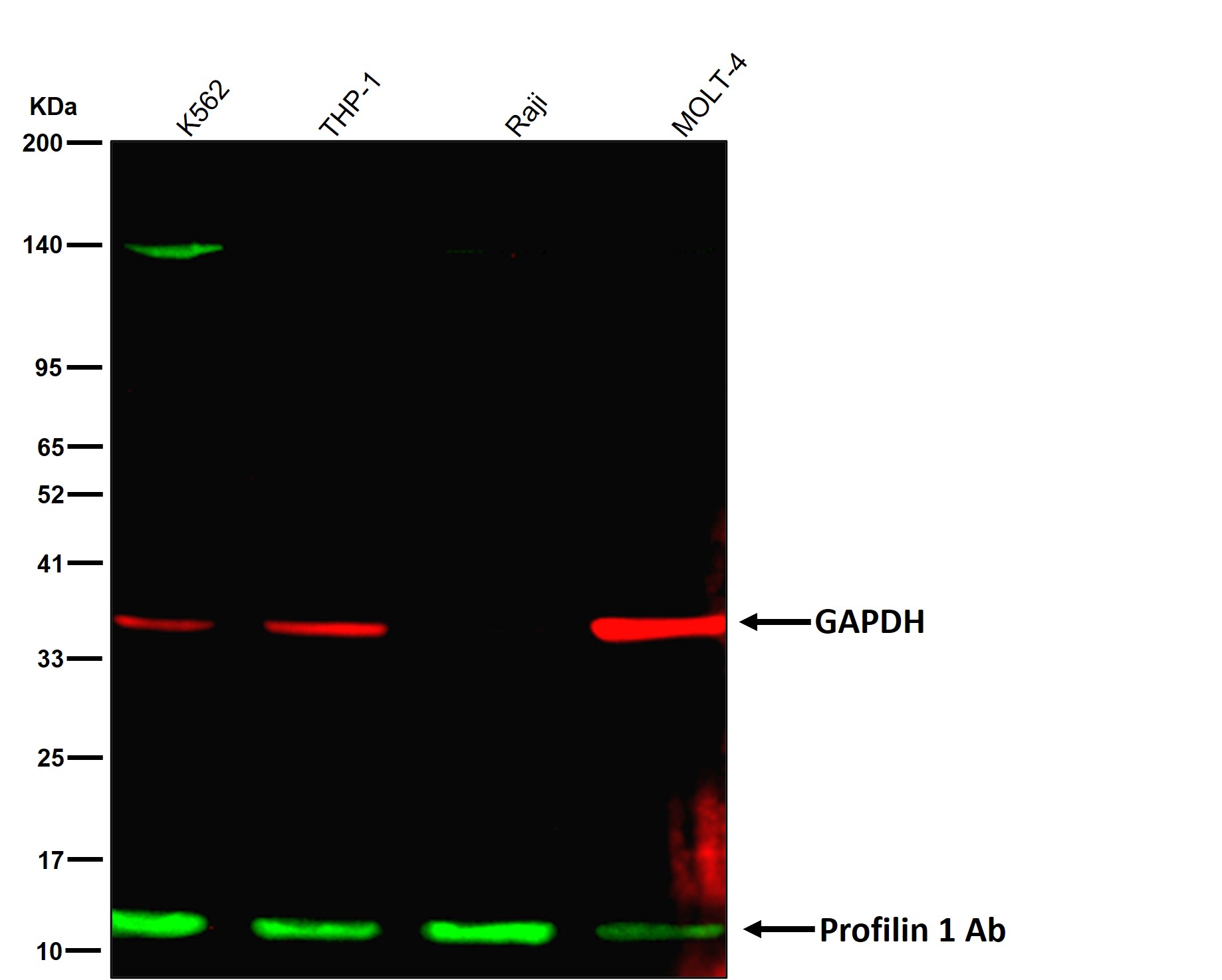 Profilin 1 Ab
