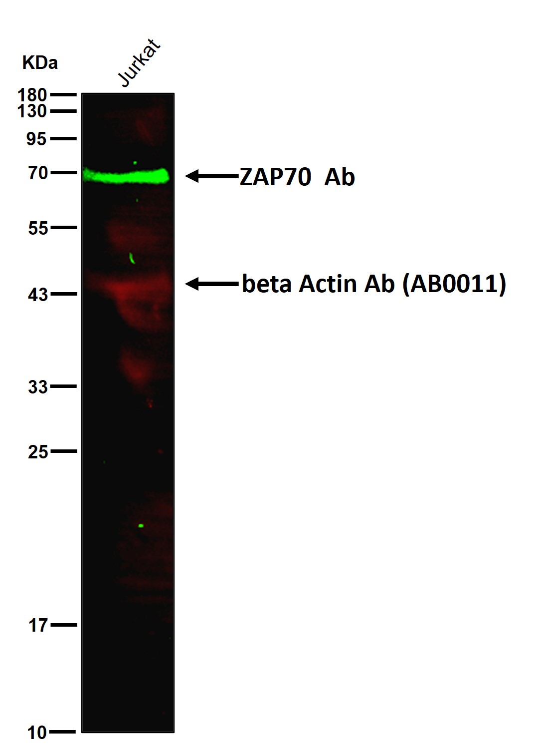 ZAP70 Ab