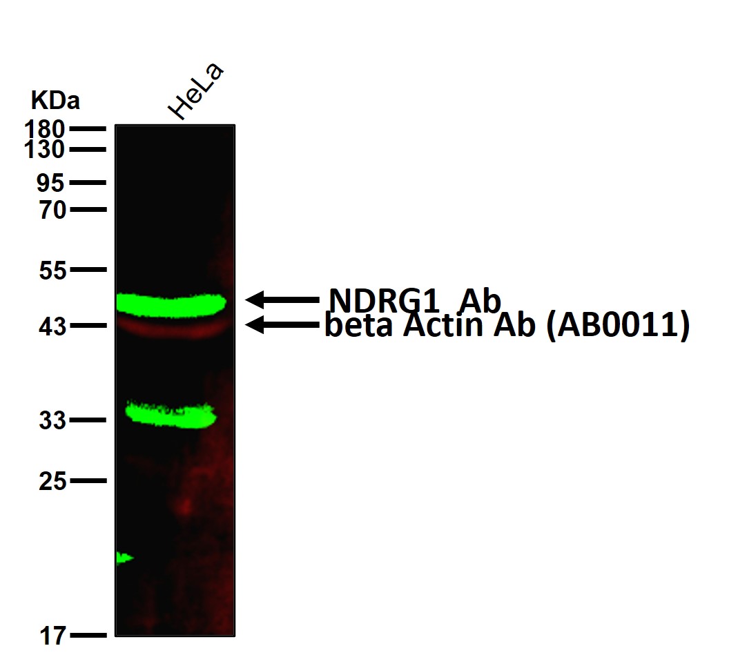 NDRG1 Ab