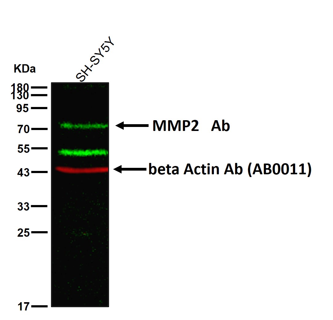 MMP2 Ab