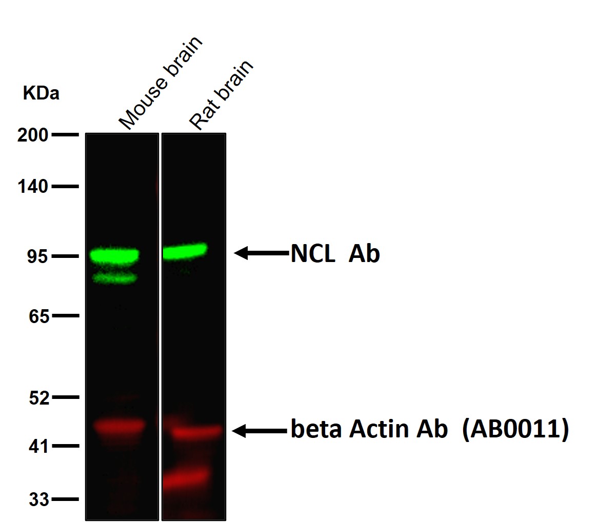 NCL Ab