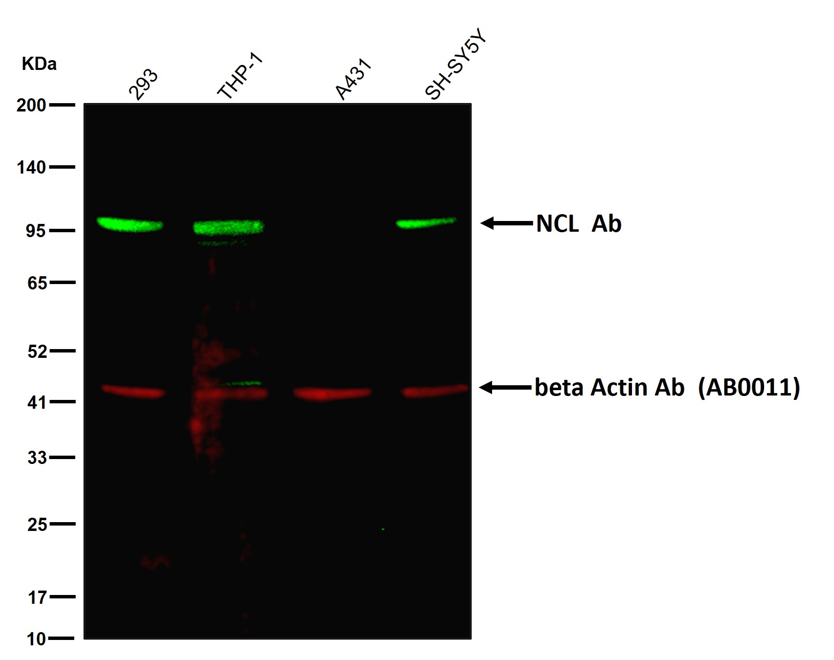 NCL Ab