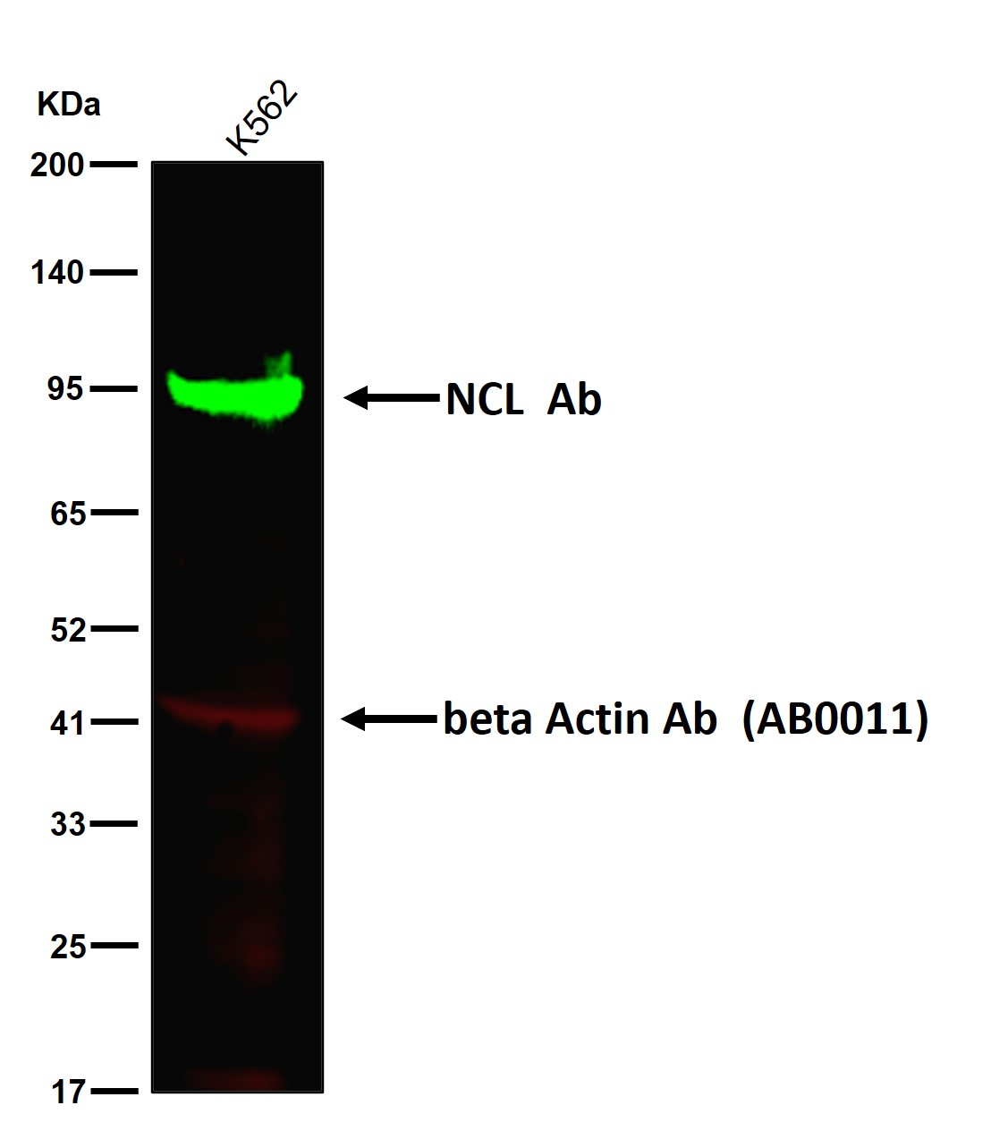 NCL Ab