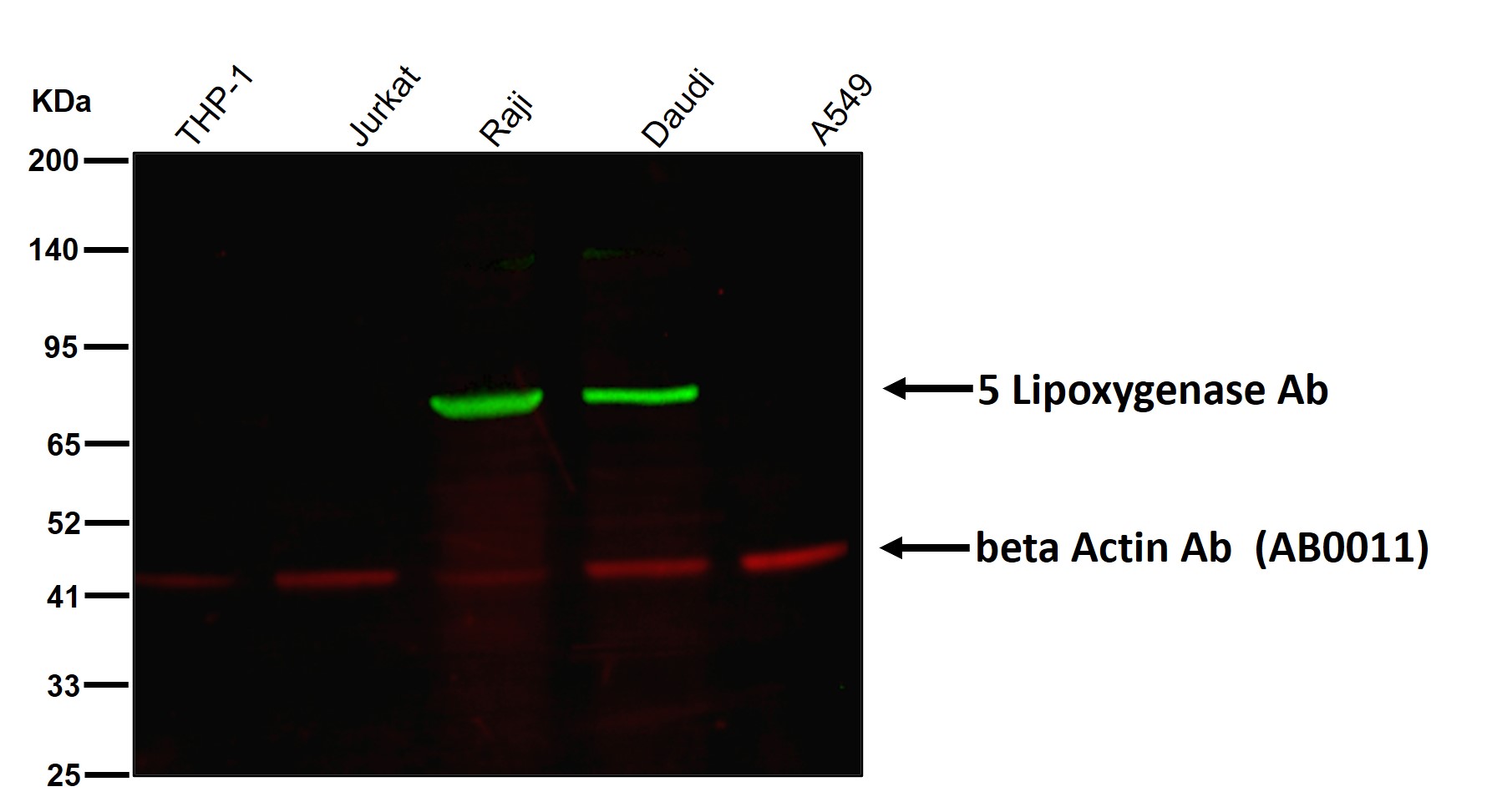5 Lipoxygenase Ab