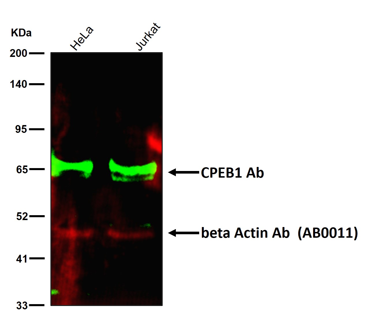 CPEB1 Ab