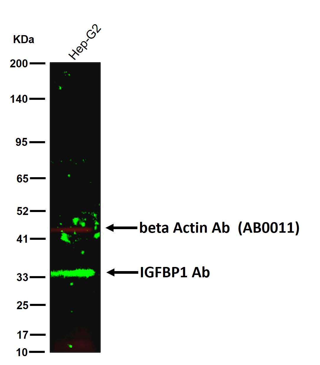 IGFBP1 Ab