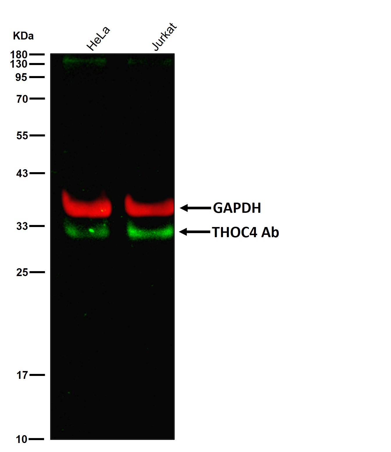 THOC4 Ab