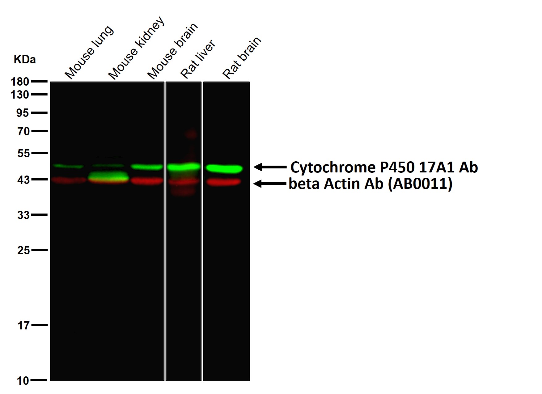 Cytochrome P450 17A1 Ab