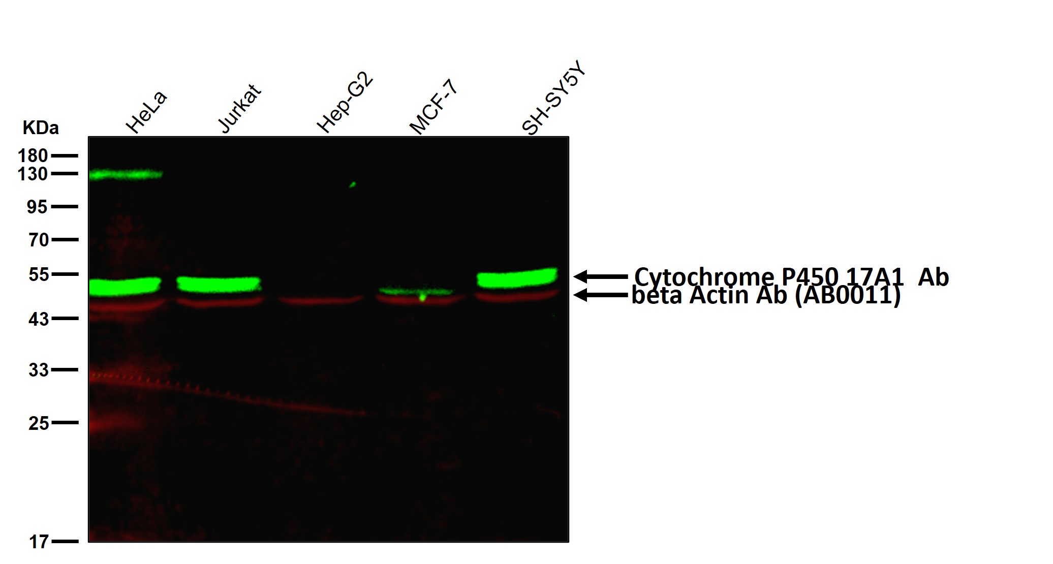 Cytochrome P450 17A1 Ab