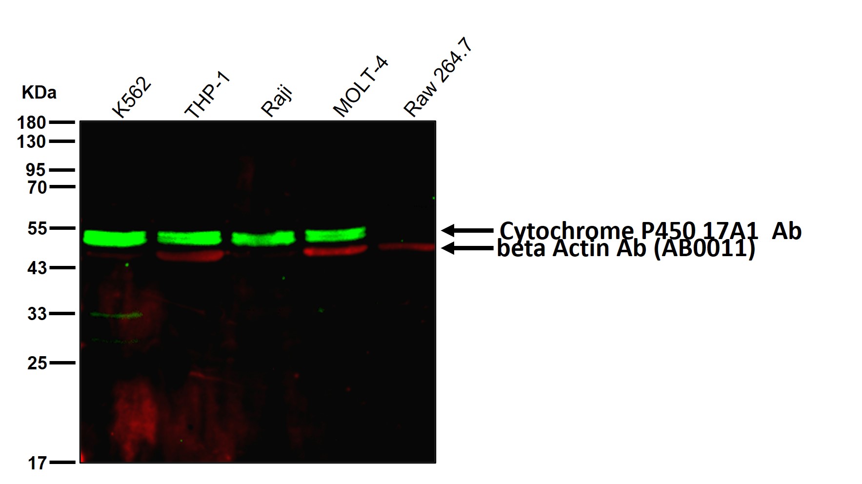 Cytochrome P450 17A1 Ab