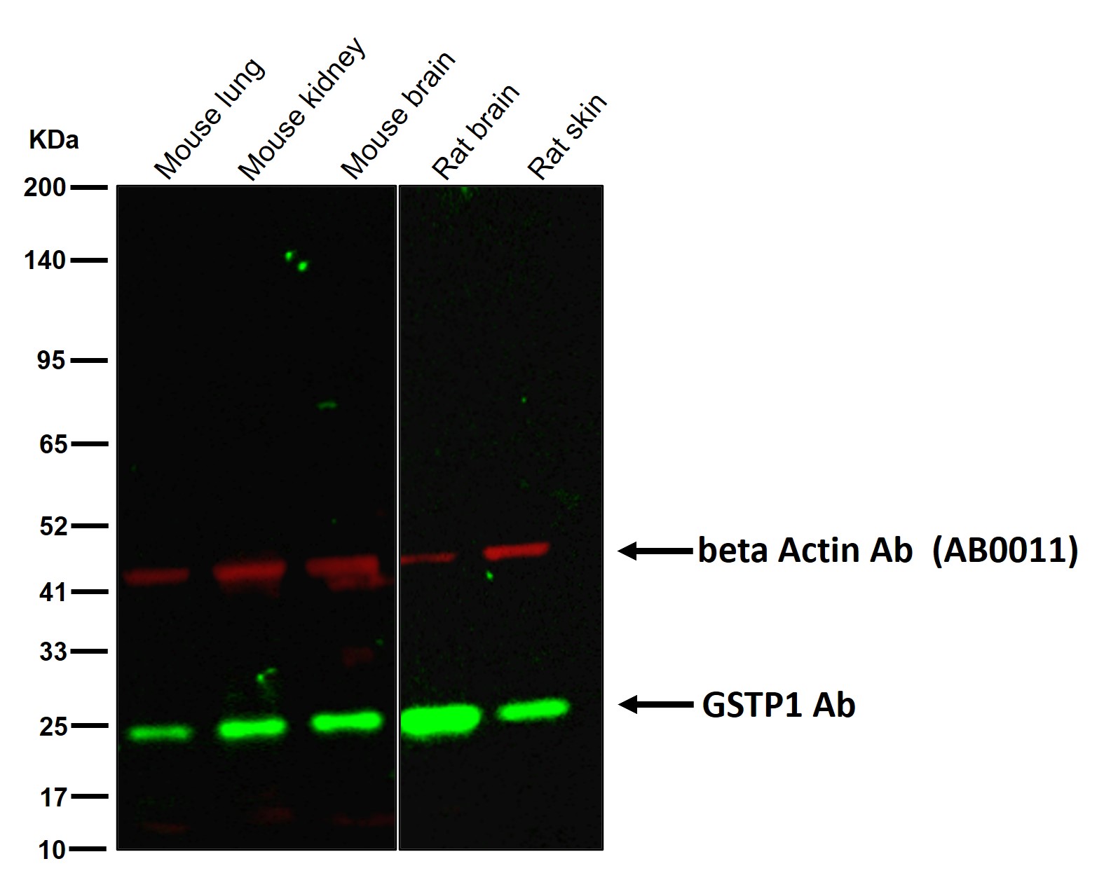 GSTP1 Ab