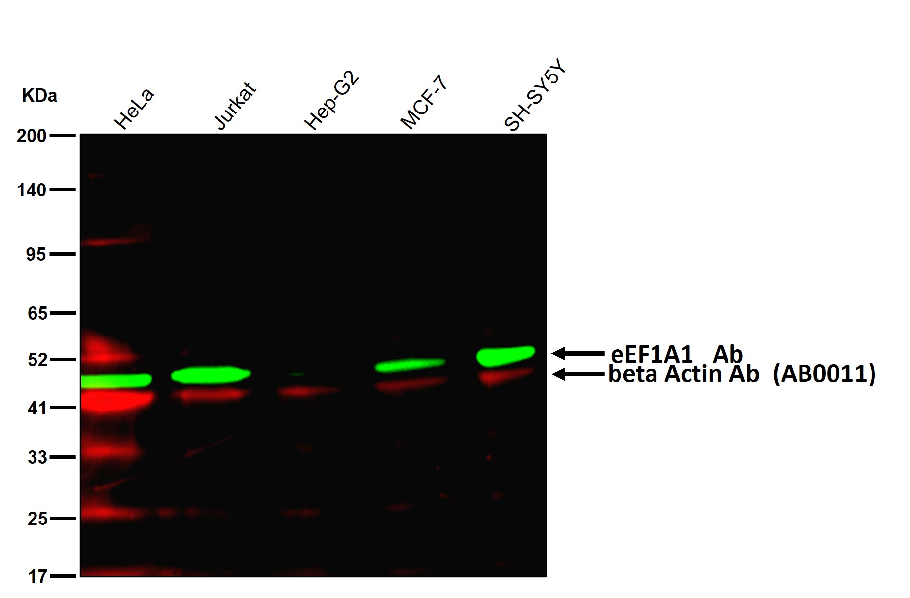 eEF1A1 Ab