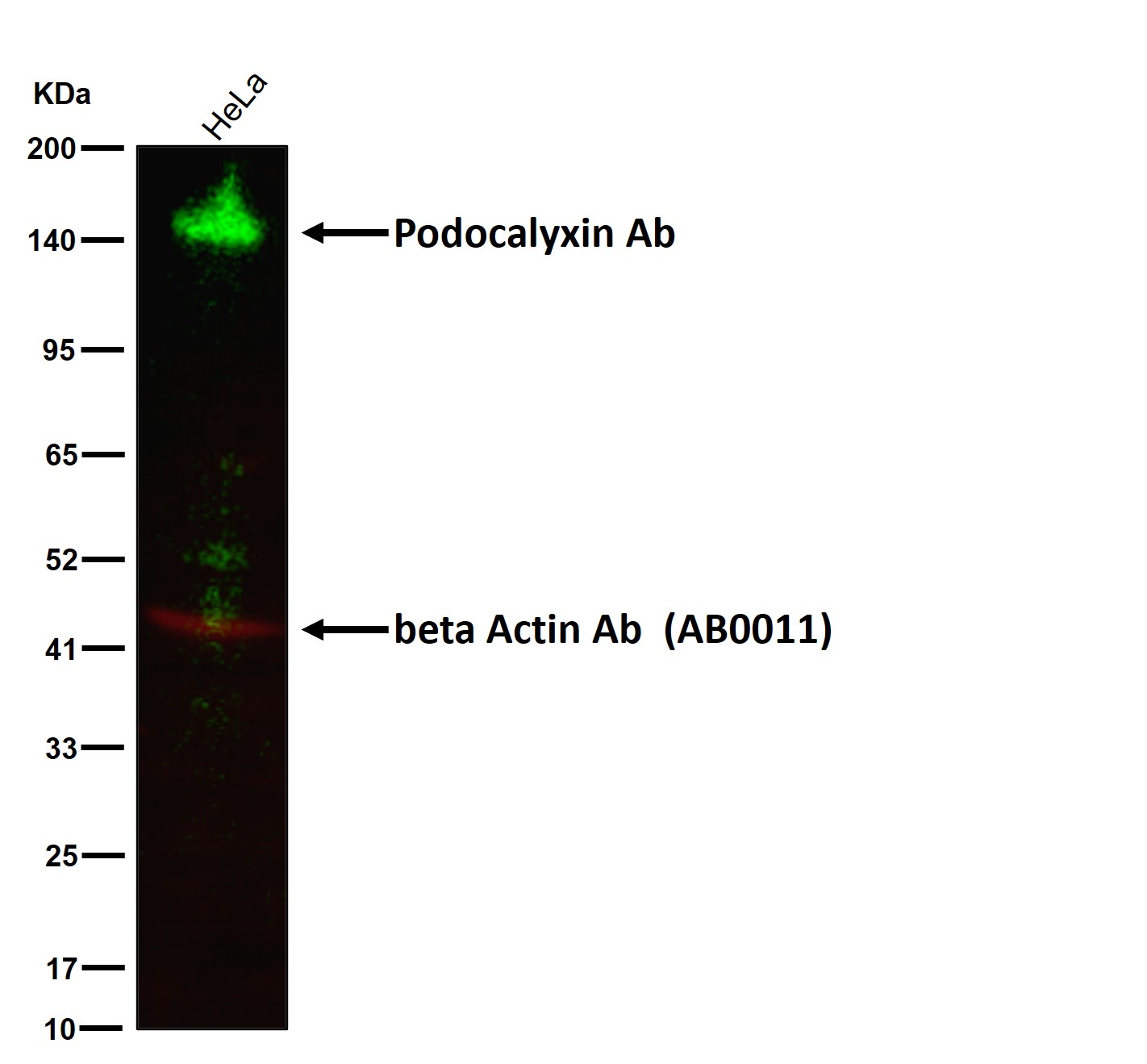 Podocalyxin Ab