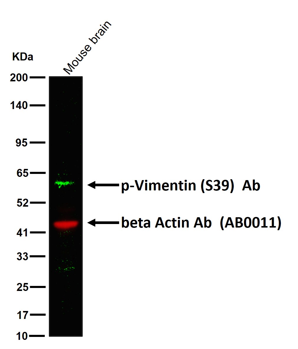 p-Vimentin (S39) Ab