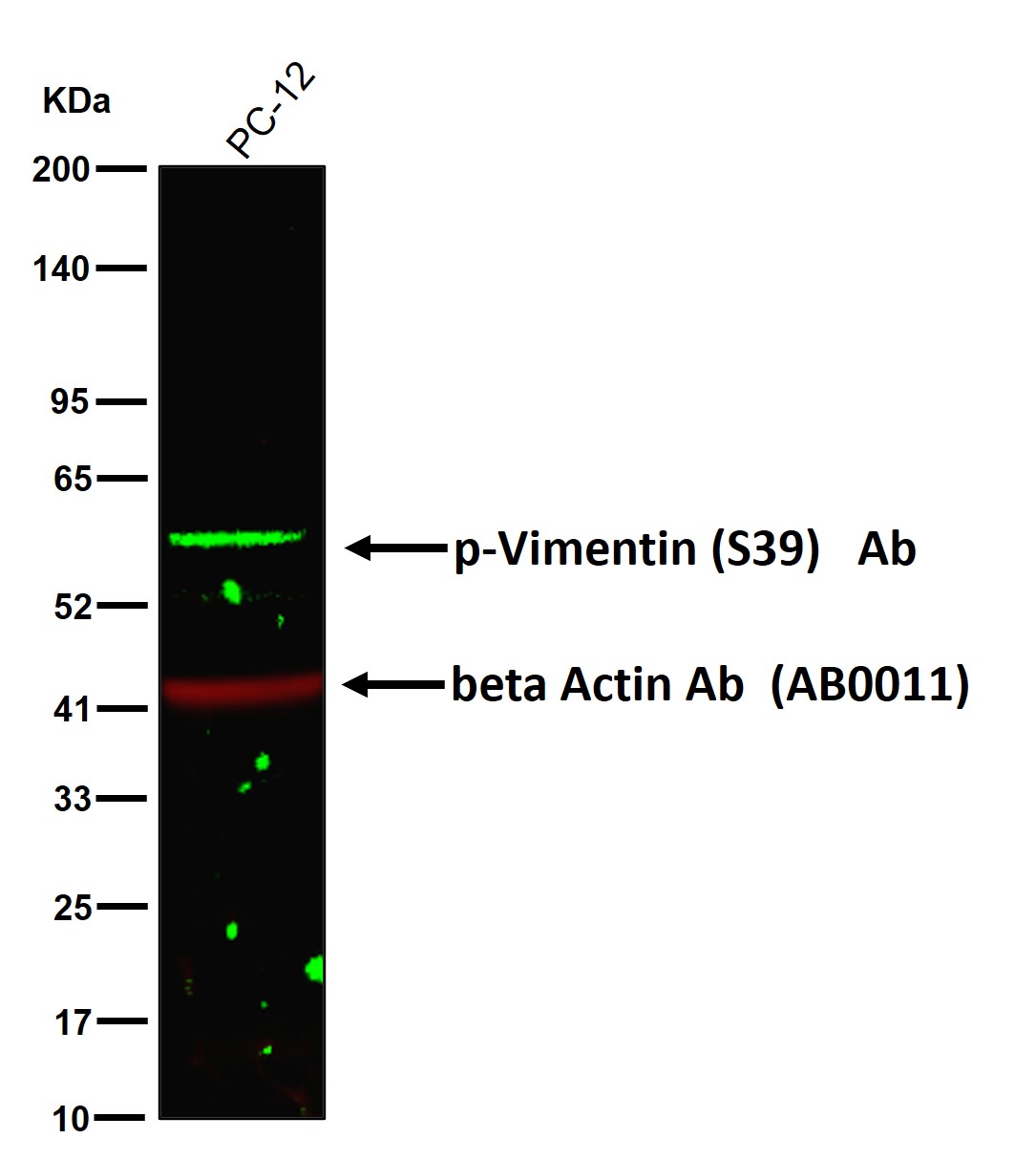 p-Vimentin (S39) Ab