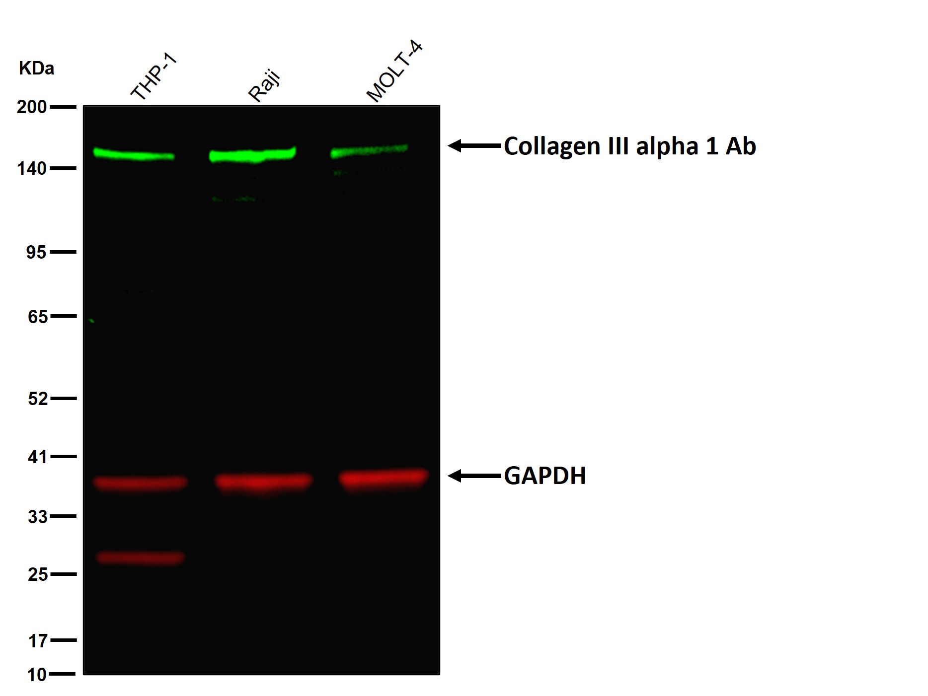 Collagen III alpha 1 Ab