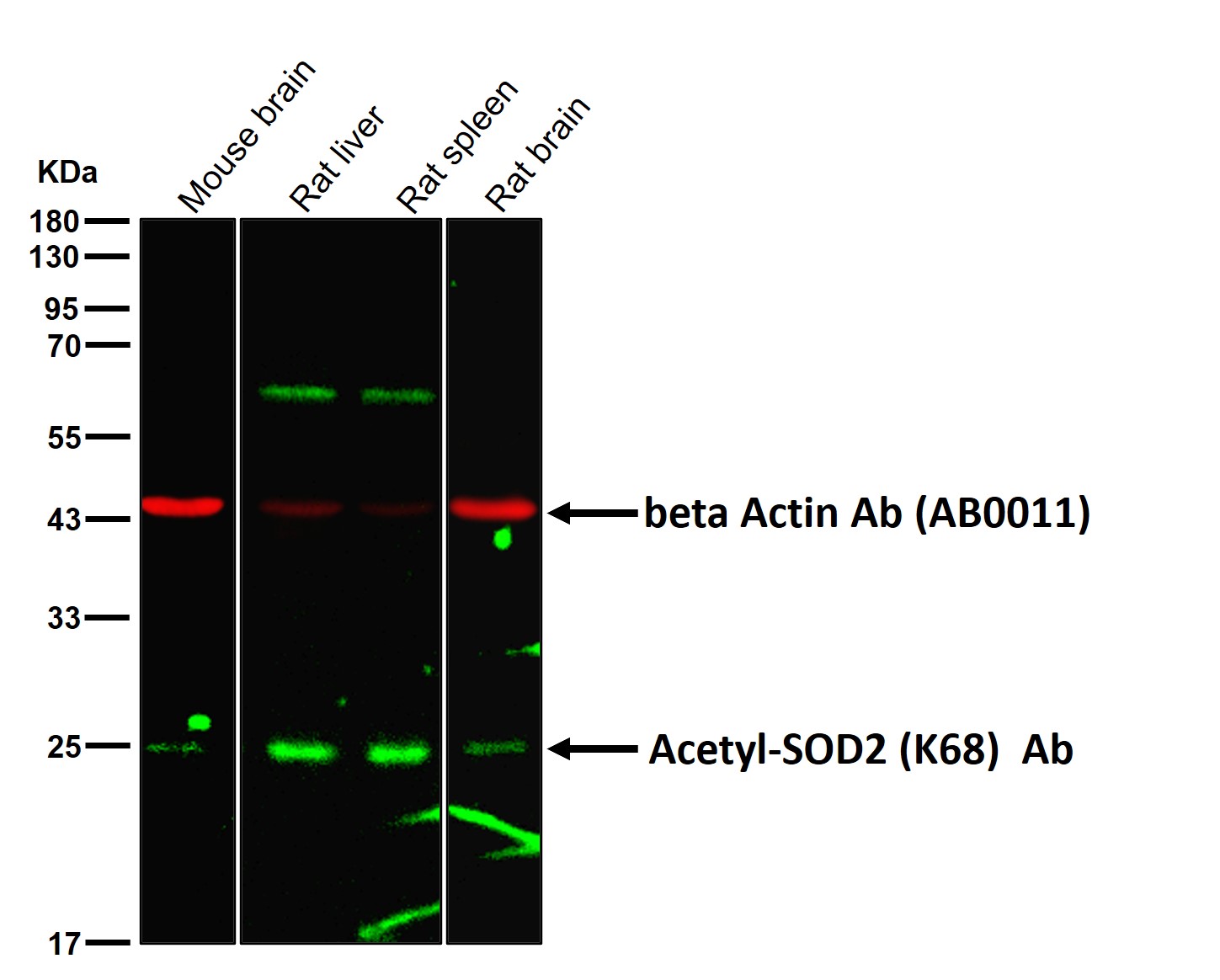 Acetyl-SOD2 (K68) Ab